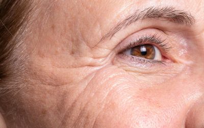 Comment ralentir l&rsquo;apparition des rides sur le visage ?